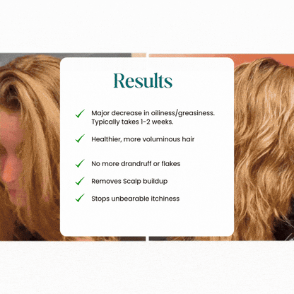 No Shampoo Hair Brush