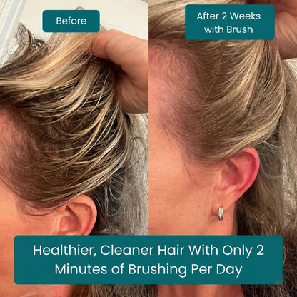 No Shampoo Hair Brush